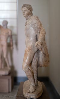 Guerriero ferito alla coscia, Collezione Farnese, Museo Archeologico di Napoli, Italia